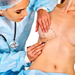 breast-enlargement-surgery-istanbul